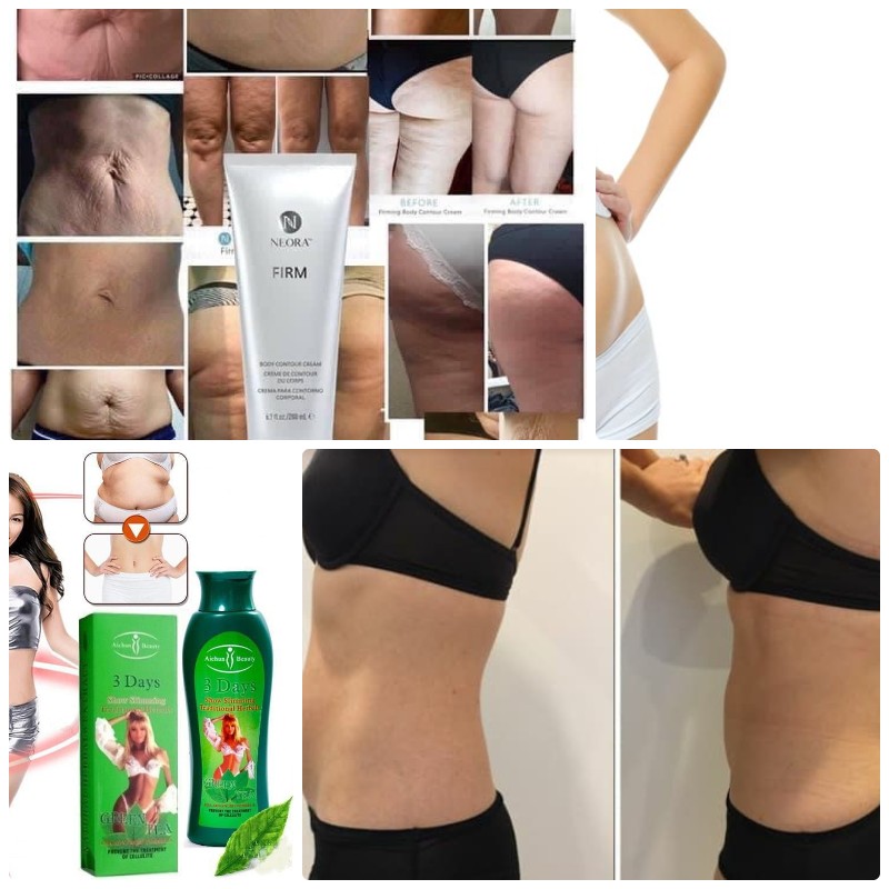 gel tan mỡ
